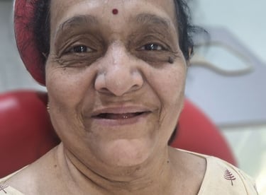 Bite collapse and worn teeth before full mouth rehabilitation treatment in Ahmedabad