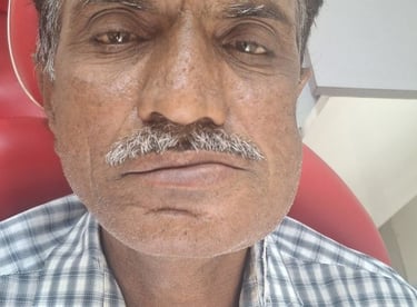 Tooth infection with swelling requiring root canal treatment at shree dental care near shyamal