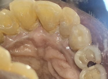 deep caries in tooth with pain and chewing problem at shree dental care