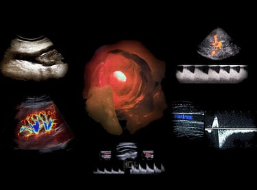 Collage of medical diagnostic images showing color Doppler ultrasound scans and endoscopic views.