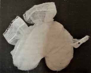 Kokyet