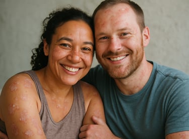 photo de couple - Journée mondiale du psoriasis