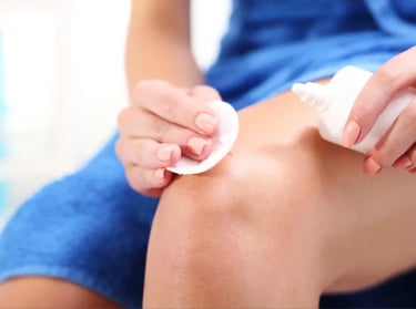 A woman applies topical skin cream to her knee using a cotton pad for targeted skincare treatment.