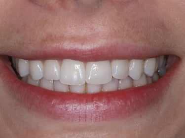 pictures of teeth