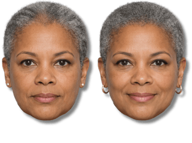 Before and after comparison of a mature woman showing hair restoration and eyebrow enhancement results.