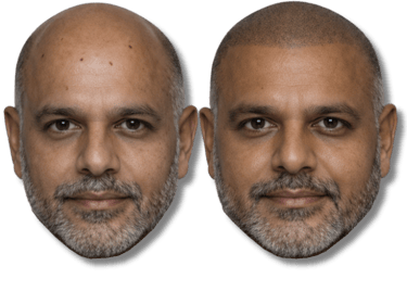 Before and after scalp micropigmentation SMP results on a man with a bald head and beard.
