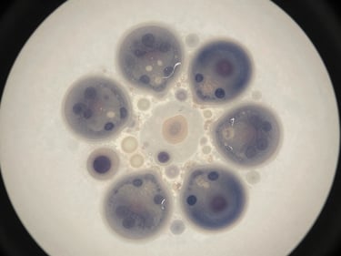 Overhead close-up of a myelodysplastic syndrome bone marrow biopsy cross-section under controlled studio lighting, showing dysplastic cell morphology within fibrous stroma, desaturated ivory and slate tones