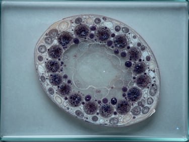 Overhead close-up of an acute myeloid leukemia bone marrow tissue section on a glass slide under cool controlled lab lighting, revealing dense blast cell clusters within stromal matrix, muted monochrome palette