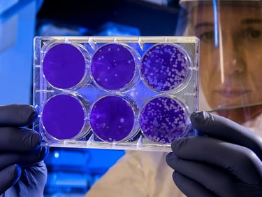 bacteria culture