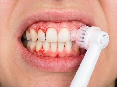 Les Inconvénients des Brosses à Dents Rotatives hygiene-precision.com