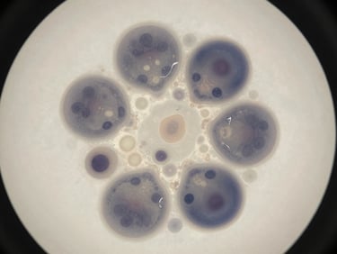 Overhead close-up of a myelodysplastic syndrome bone marrow biopsy cross-section under controlled studio lighting, showing dysplastic cell morphology within fibrous stroma, desaturated ivory and slate tones