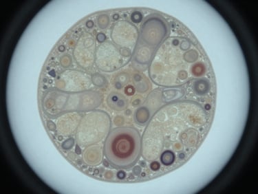 Overhead macro photograph of an aplastic anemia bone marrow biopsy section under controlled cool lighting, hypocellular marrow space visible with sparse stromal elements, muted gray and bone-white tones