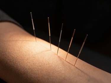 Close-up of acupuncture needles placed precisely along a meridian, warm studio spotlight, deep black background, sharp focus