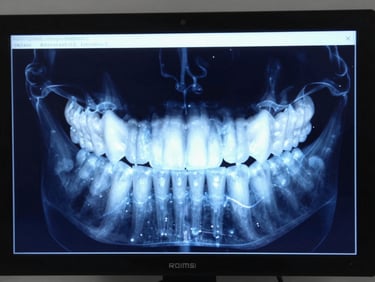 High-contrast clinical screen displaying a 3D dental jaw render with electric blue diagnostic overlays, medical software interface, dark navy background