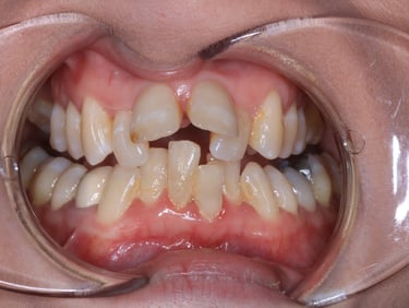pictures of teeth