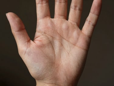 Close-up of a palm showing a vertical fate line rising from wrist toward middle finger, clinical window light, fine skin texture visible, neutral dark background, medium skin tone