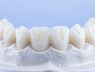 Macro close-up of a flawless monolithic zirconia crown on a stone model, bright clinical studio lighting, shallow depth of field