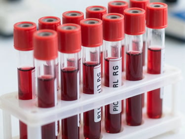 Close-up of a PRP vial filled with golden platelet-rich plasma on a sterile clinical surface, cool white light, sharp focus