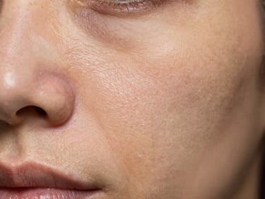Close-up of periorbital and nasolabial skin showing fine lines and volume loss under warm studio strobe, clinical documentation framing, no retouching