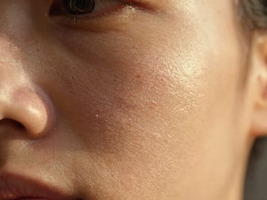Close-up of skin with slightly blocked pores before treatment, showing minor congestion, under soft golden-hour window light, macro depth of field
