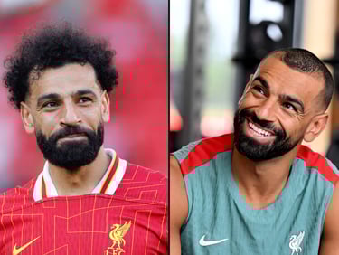 زراعة الشعر محمد صلاح