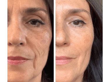 Elixir da Beleza 02- Skinbooster