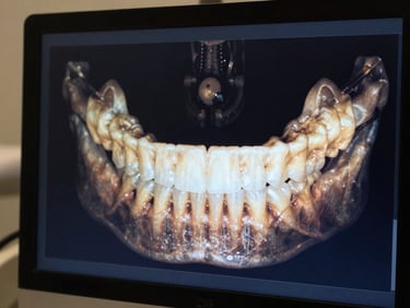 Close-up of a digital 3D dental scan on a dark monitor screen, soft ambient clinic lighting, deep navy tones.