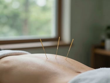 Acupuncture needles placed gently on a patient's back, soft focus, serene clinical wellness environment