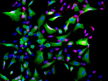Fluorescently labelled cells from the CTIBIOTECH Biobank. Tissue sourcing.