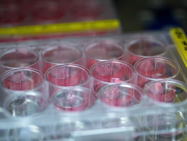 Plate of human cells being used for safer drug testing. CTIBIOTECH. Biobank.