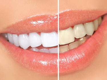 Dentística Odonto Medyc