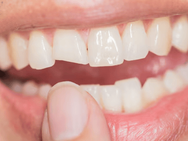 Dentística Odonto Medyc