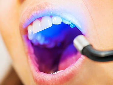 Laserterapia Focada Odonto Medyc