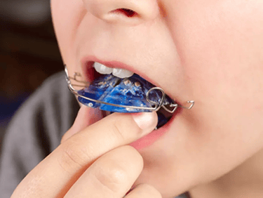 Ortodontia Odonto Medyc