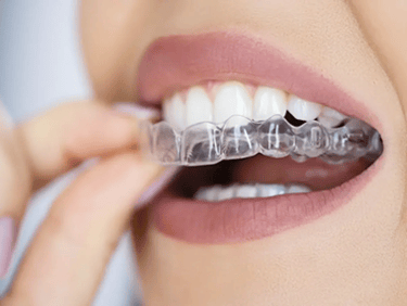 Ortodontia Odonto Medyc