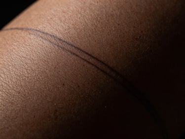 Macro shot of a clean, healed skin area showing the faint outline of a faded tattoo, soft chiaroscuro lighting, professional clinical aesthetic