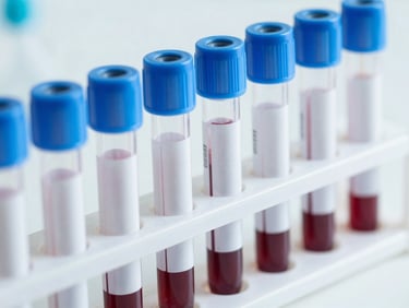 A row of sealed blood collection tubes with blue caps in a rack, sharp focus, sterile white background.