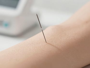 Macro close-up of a sterile acupuncture needle gently placed on a hand, soft clinical lighting, warm sand tones, play overlay icon, 35mm lens.