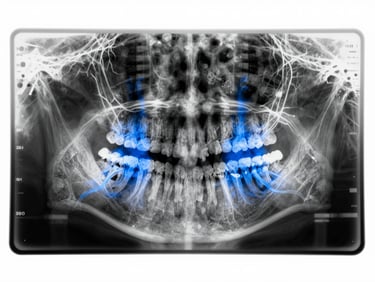 High-resolution monochrome dental X-ray with clean electric blue digital AI overlay highlighting a precise root structure, crisp high-key studio lighting, scientific readout.