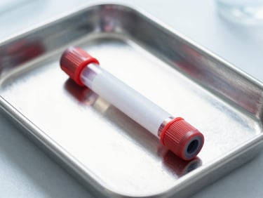 Crisp macro shot of a sealed sterile blood collection tube on a clean metal lab tray, high-key lighting