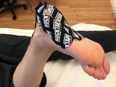 "Individu recevant une thérapie par bande kinésiologique (K-tape) à A.S. Sport Clinic, avec un thérapeute.