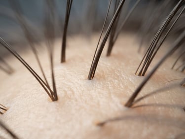 Macro photography of healthy hair follicles, clean clinical aesthetic, soft diffused daylight, warm beige tones, high-end medical aesthetic.
