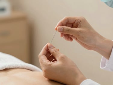 Close-up of a professional practitioner's hands placing a sterile acupuncture needle, soft warm lighting, clinical environment, 35mm photography
