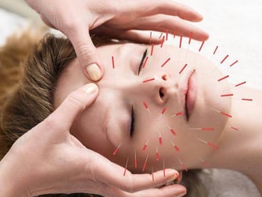 Cosmetic Acupuncture: Natural facial acupuncture to reduce fine lines, lift skin and restore healthy