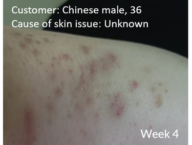 skin1