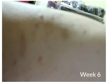 skin 2