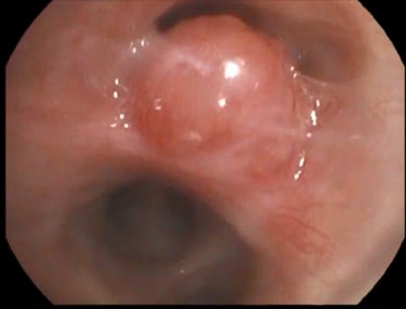 Bronchoscopy private service