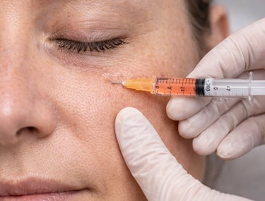 Dermatologist performing a facial dermal filler injection under a patient's eye for skin rejuvenation.