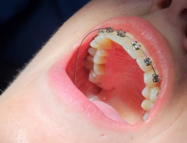 brackets metalicos badajoz