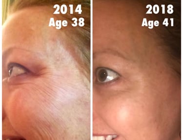 Skin peptides result